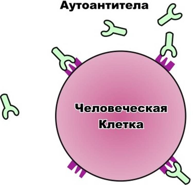 Генетика сахарного диабета 1 типа..Диабет, сахарный диабет, СД1 типа, СД 2 типа, Правило 15.